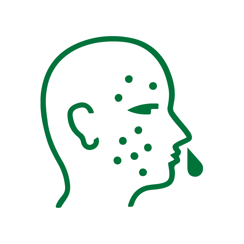 ԱԼԵՐԳՈԼՈԳԻԱ, ԻՄՈՒՆՈԼՈԳԻԱ, ԹՈՔԱԲԱՆՈՒԹՅՈՒՆ