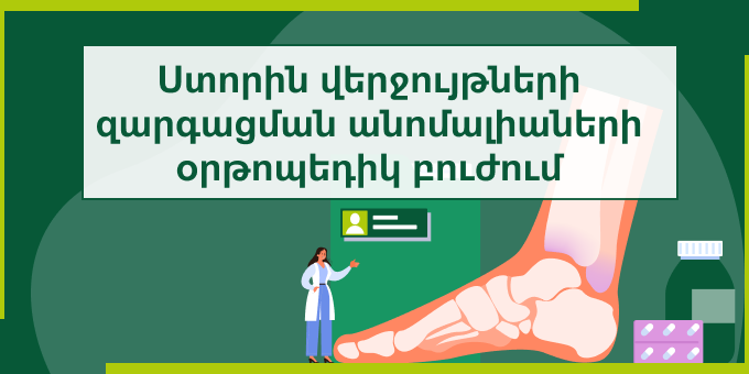 Ստորին վերջույթների զարգացման անոմալիաների օրթոպեդիկ բուժում